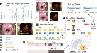 Computer-aided diagnosis of cervical dysplasia using colposcopic images